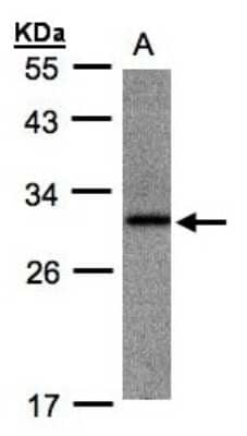 Western Blot: ANKRD7 Antibody [NBP1-31621]