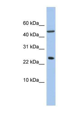 Western Blot: ANKRD7 Antibody [NBP1-57699]