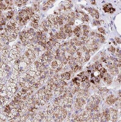 Immunohistochemistry: ANKRD9 Antibody [NBP2-30478]