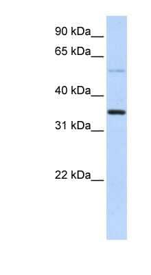 Western Blot: ANKRD9 Antibody [NBP1-56900]