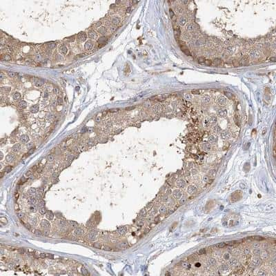 Immunohistochemistry: ANKS1A Antibody [NBP1-89078]