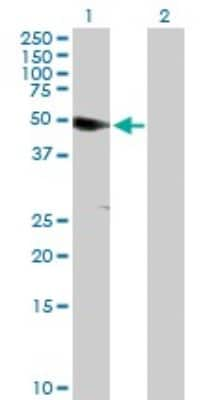 Western Blot: ANKS1A Antibody [H00023294-B01P]