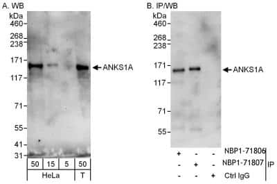 Western Blot: ANKS1A Antibody [NBP1-71806]