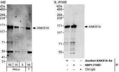 Western Blot: ANKS1A Antibody [NBP1-71807]