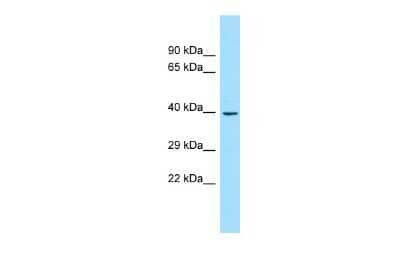 Western Blot: ANKS1B Antibody [NBP3-10686]