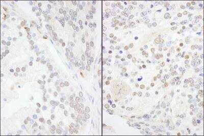Immunohistochemistry-Paraffin: ANKS3 Antibody [NB100-61625]