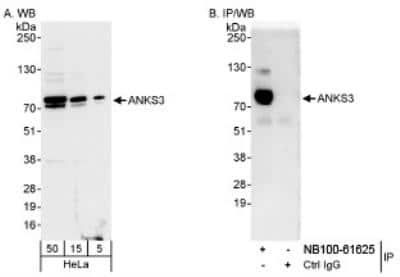 Western Blot: ANKS3 Antibody [NB100-61625]