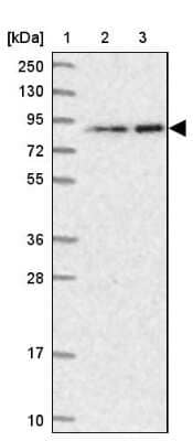 Western Blot: ANKS3 Antibody [NBP1-83531]