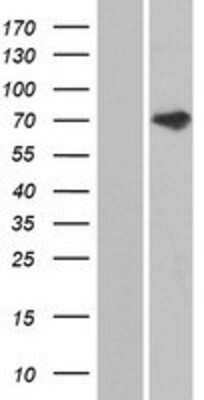 Western Blot: ANKS3 Overexpression Lysate [NBP2-05698]