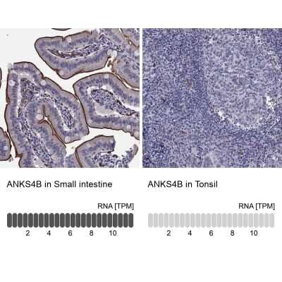 Immunocytochemistry/ Immunofluorescence: ANKS4B Antibody [NBP3-17132]