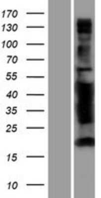 Western Blot: ANKS4B Overexpression Lysate [NBP2-05456]