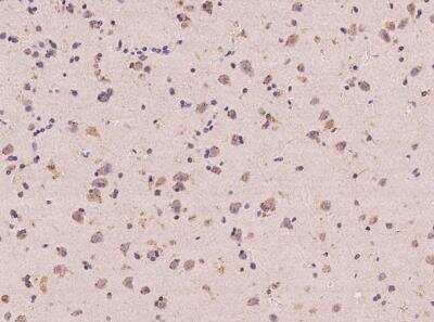 Immunohistochemistry-Paraffin: ANKS6 Antibody [NBP3-06064]