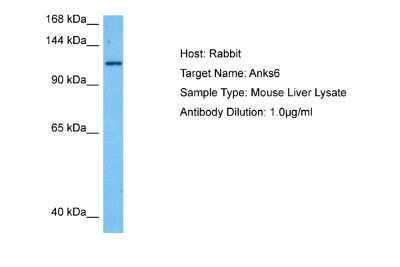 Western Blot: ANKS6 Antibody [NBP2-82625]