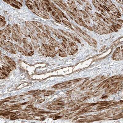 Immunohistochemistry-Paraffin: ANKZF1 Antibody [NBP1-84627]