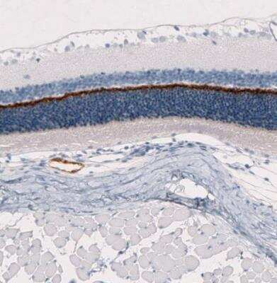 Immunohistochemistry-Paraffin: ANO2 Antibody (CL10632) [NBP3-07992]