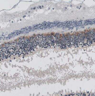 Immunohistochemistry-Paraffin: ANO2 Antibody (CL10632) [NBP3-07992]