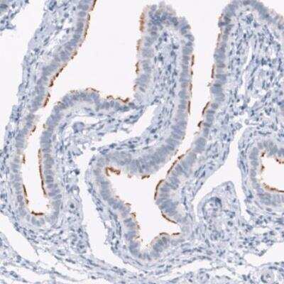 Immunohistochemistry-Paraffin: ANO2 Antibody (CL10632) [NBP3-07992]