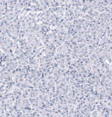 Immunohistochemistry-Paraffin: ANO2 Antibody (CL10632) [NBP3-07992]