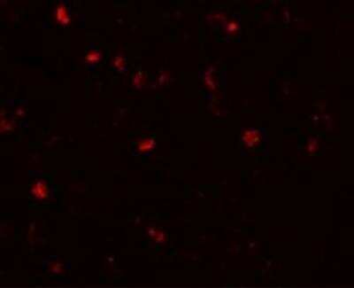 Immunocytochemistry/ Immunofluorescence: ANO2 Antibody - BSA Free [NBP2-81703]