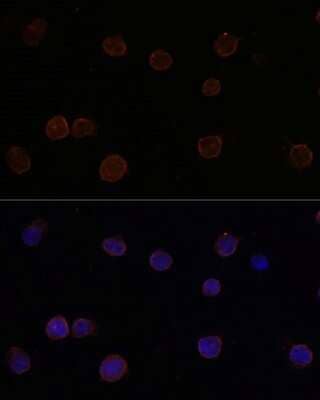 Immunocytochemistry/ Immunofluorescence: ANO2 Antibody - Azide and BSA Free [NBP2-92888]