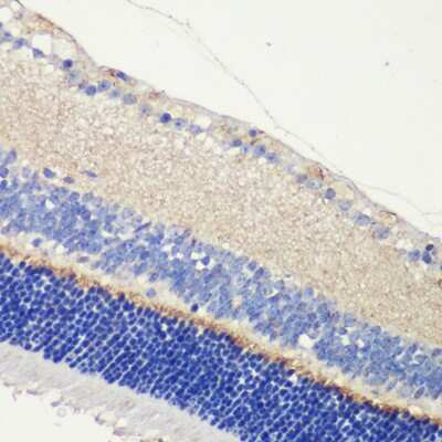 Immunohistochemistry-Paraffin: ANO2 Antibody - Azide and BSA Free [NBP2-92712]