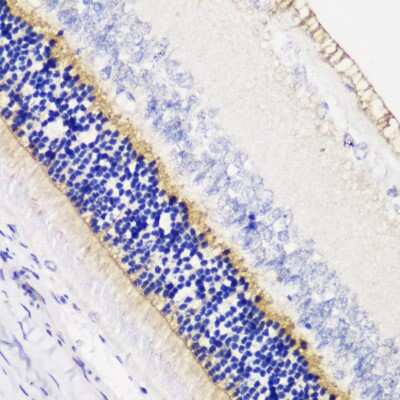 Immunohistochemistry-Paraffin: ANO2 Antibody - Azide and BSA Free [NBP2-92712]