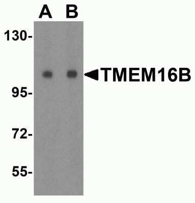 Western Blot: ANO2 AntibodyBSA Free [NBP2-81703]