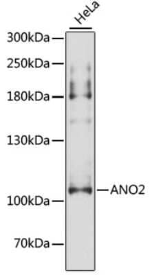 Western Blot: ANO2 AntibodyAzide and BSA Free [NBP2-92712]