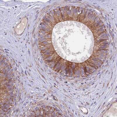 Immunohistochemistry-Paraffin: ANO3 Antibody [NBP1-88546]
