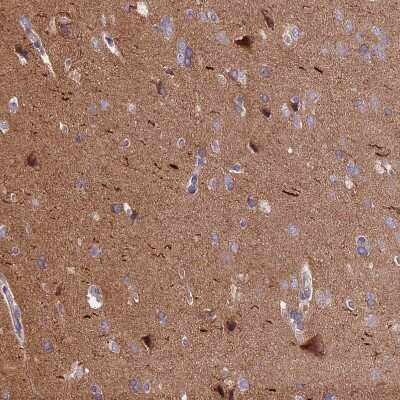 Immunohistochemistry-Paraffin: ANO3 Antibody [NBP1-88546]