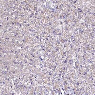 Immunohistochemistry-Paraffin: ANO3 Antibody [NBP1-88546]