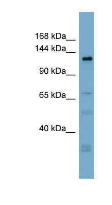 Western Blot: ANO3 Antibody [NBP1-70409]