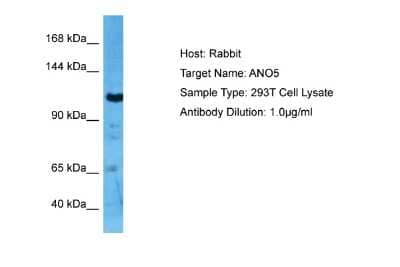 Western Blot: ANO5 Antibody [NBP2-82626]