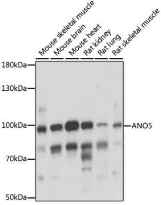 Western Blot: ANO5 AntibodyAzide and BSA Free [NBP2-92217]