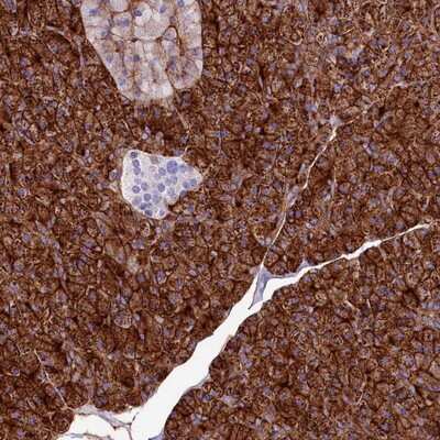 Immunohistochemistry-Paraffin: ANO6 Antibody [NBP1-84207]