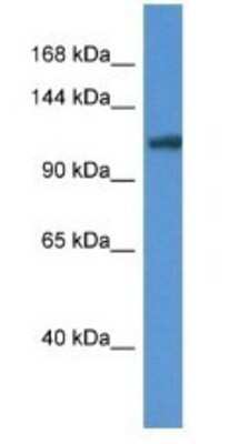 Western Blot: ANO6 Antibody [NBP1-74204]