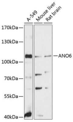 Western Blot: ANO6 AntibodyAzide and BSA Free [NBP2-92052]