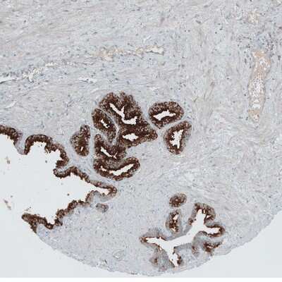 Immunohistochemistry-Paraffin: ANO7 Antibody [NBP1-83099]