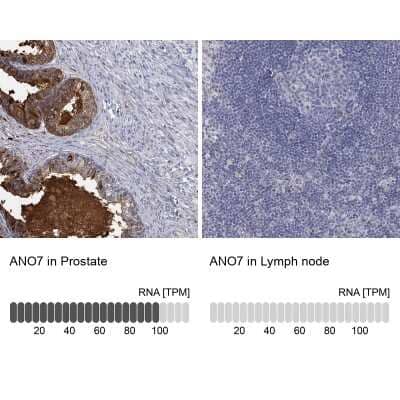 Immunohistochemistry-Paraffin: ANO7 Antibody [NBP3-17120]