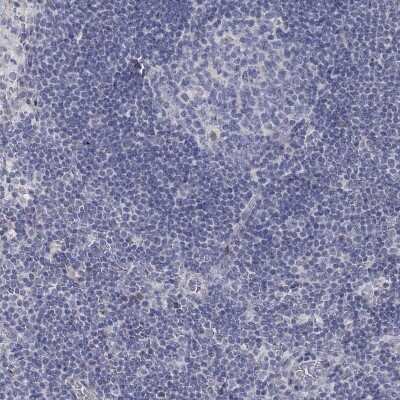 Immunohistochemistry-Paraffin: ANO7 Antibody [NBP3-17120]