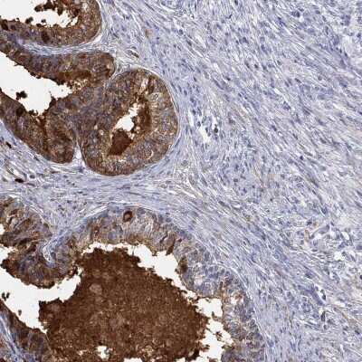 Immunohistochemistry-Paraffin: ANO7 Antibody [NBP3-17120]