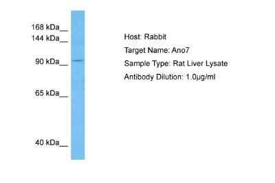 Western Blot: ANO7 Antibody [NBP2-82630]