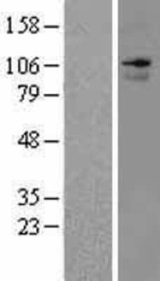 Western Blot: ANO7 Overexpression Lysate [NBL1-17034]