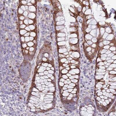 Immunohistochemistry-Paraffin: ANO8 Antibody [NBP2-14673]