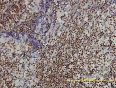 Immunohistochemistry-Paraffin: ANP32A Antibody (2G11-4A5) [H00008125-M01]