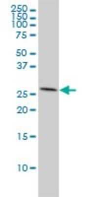 Western Blot: ANP32A Antibody (2G11-4A5) [H00008125-M01]