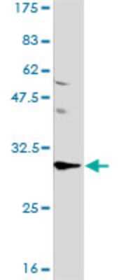 Western Blot: ANP32A Antibody (2G11-4A5) [H00008125-M01]