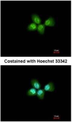 Immunocytochemistry/ Immunofluorescence: ANP32A Antibody [NBP2-15412]