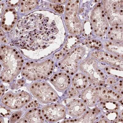 Immunohistochemistry: ANP32A Antibody [NBP2-49519]