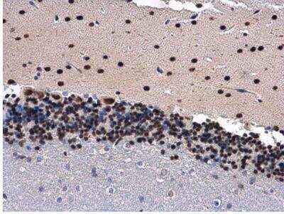 Immunohistochemistry-Paraffin: ANP32A Antibody [NBP2-15412]